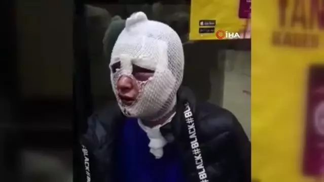 İskenderun'da eski sözlü dehşeti... Uyuşturucu madde verip cinsel şiddette bulundu, üzerine kızgın yağ dökerek tanınmaz hale getirdi