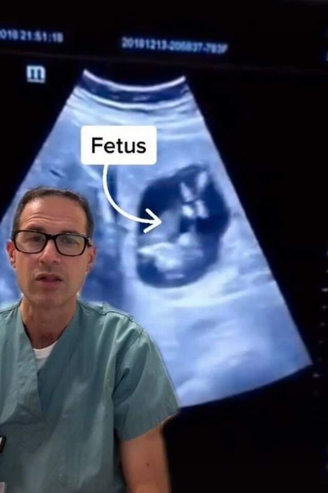 Tıp dünyası şokta! Genç kadın hamile kaldı ama bebek karaciğerinde