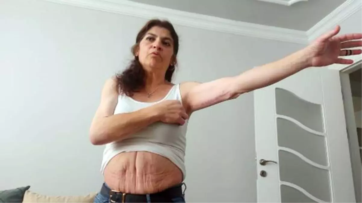 Estetik sonrası hayatı kabusa dönen kadın, yaşadığı acı dolu süreci anlattı: Rüyalarımda doktor gözlerimi oyuyordu