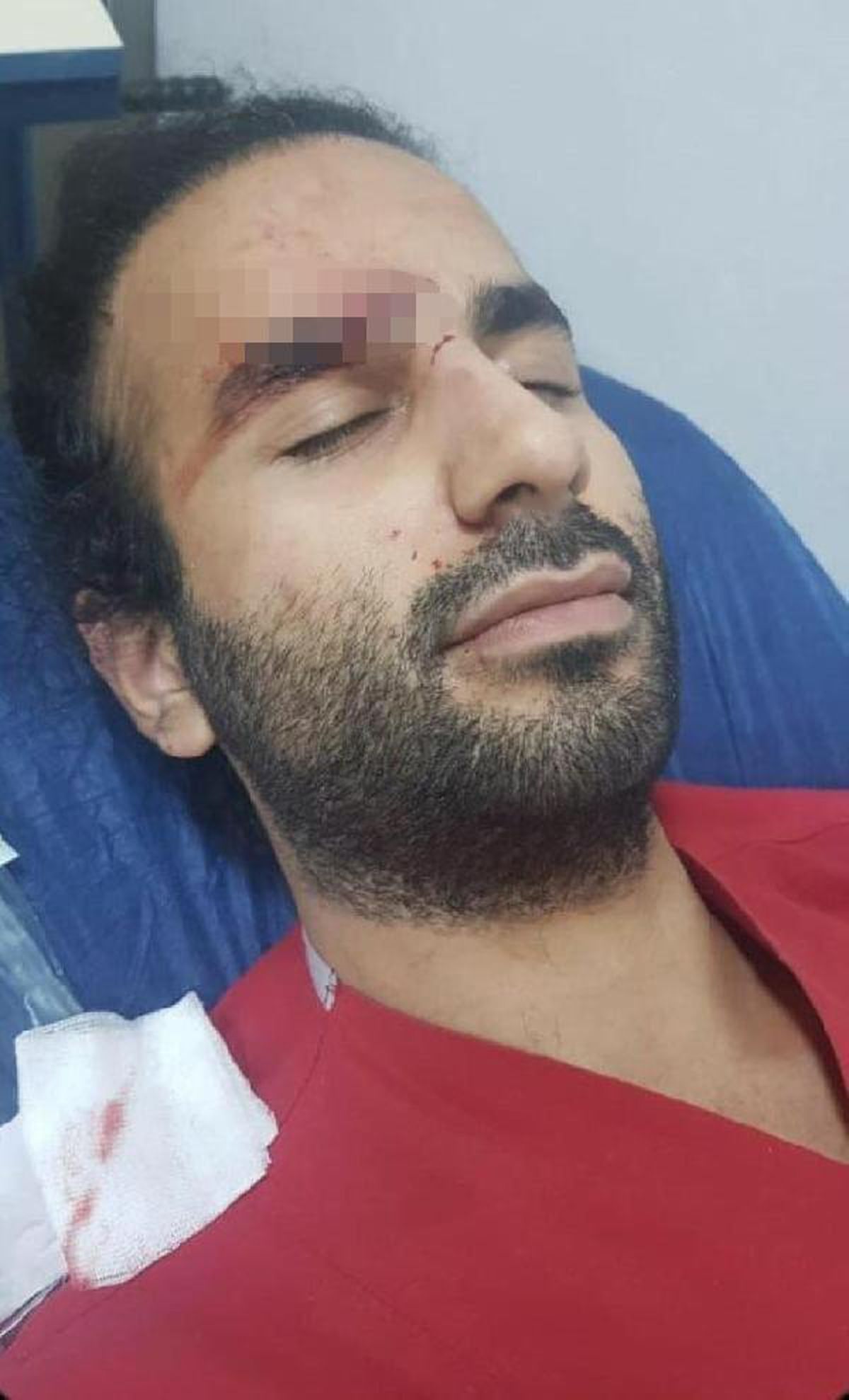 Didim\'de doktora kafa atan şüpheli tekrar gözaltına alındı