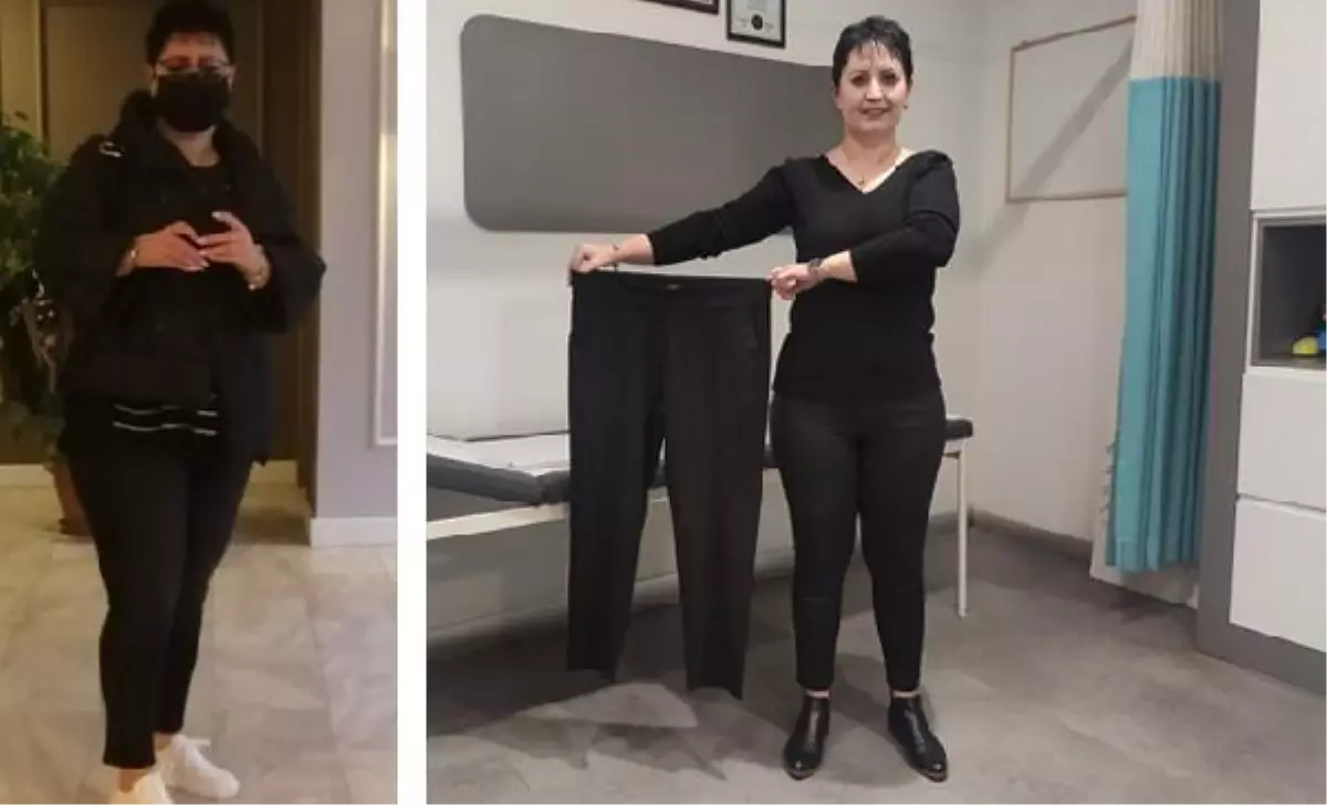 AYNALARA KÜSMÜŞTÜ; 15 DAKİKALIK ENDOSKOPİK İŞLEMLE 17 KİLO VERDİ