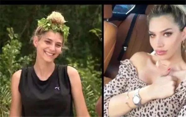 Survivor'da yarışan o ismin estetiksiz hali ortaya çıktı