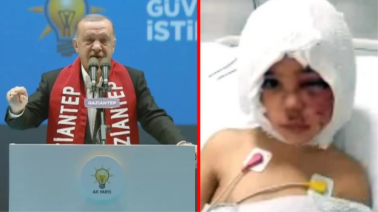Cumhurbaşkanı Erdoğan küçük kıza saldıran pitbullar için isyan etti: Bunlar, parası bol olanların köpekleri
