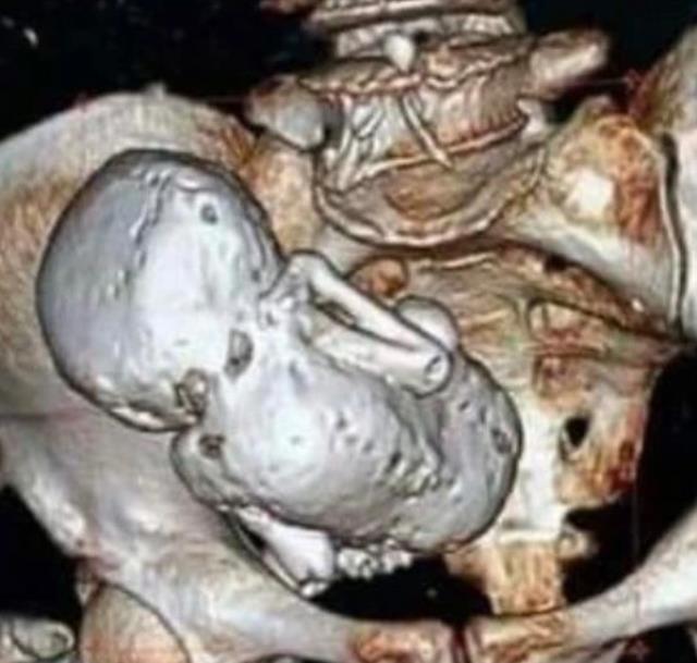 Dünya bu korkunç olayı konuşuyor! Kadının ultrason görüntüsüne bakan doktor hemen yetkilileri aradı