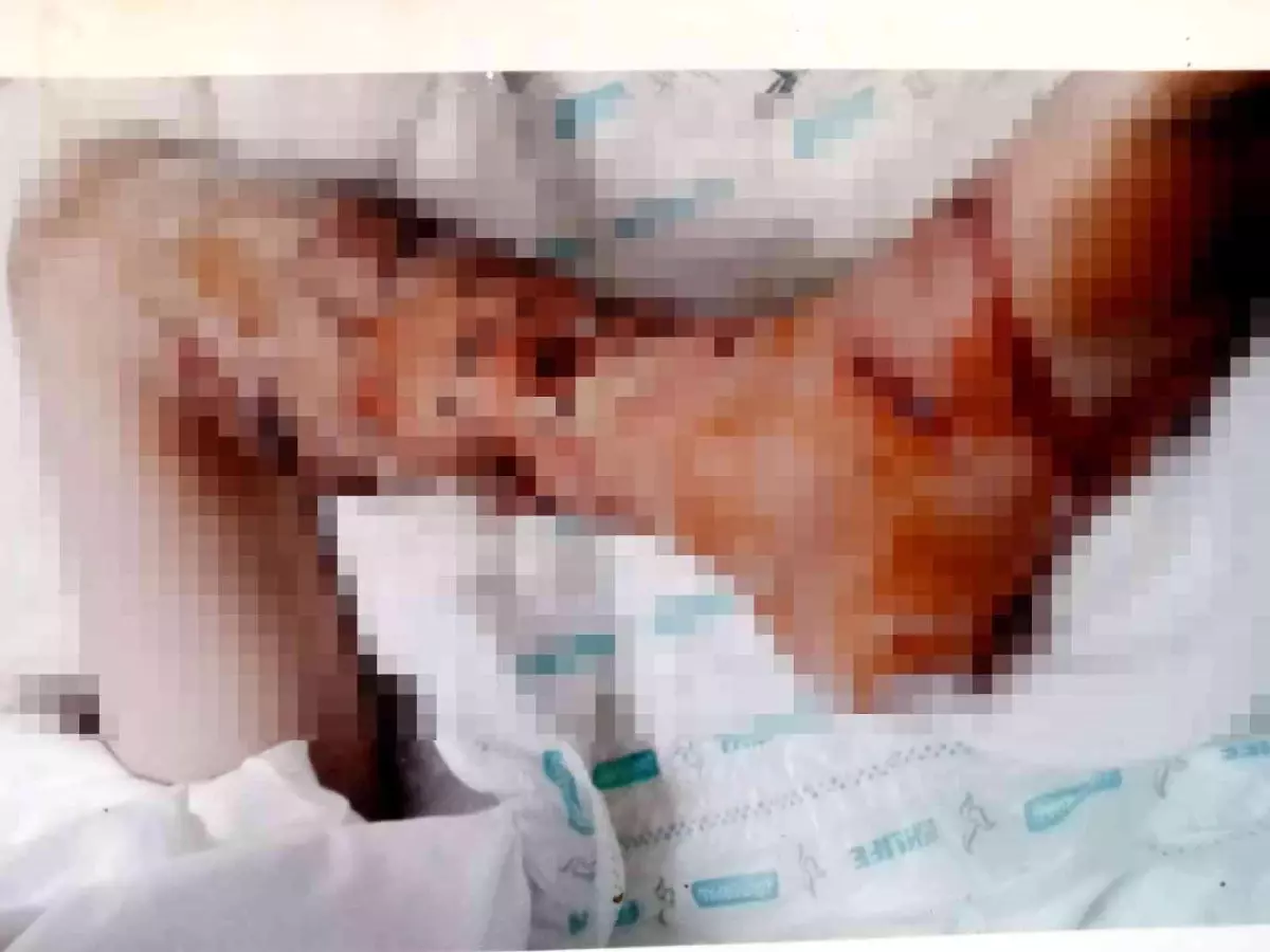 Son dakika: 4 yıl önce pitbull saldırısına uğrayan çocuk, psikolojik tedavi alıyor