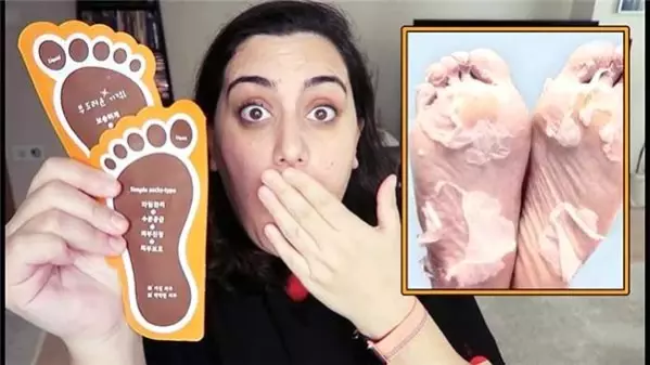 Ünlü isimlerin tercih ettiği ayak maskesi