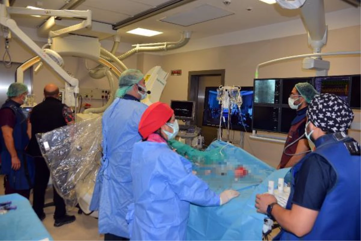 Kalp kapağı değişimi ameliyatını doktorlar canlı yayınla izledi