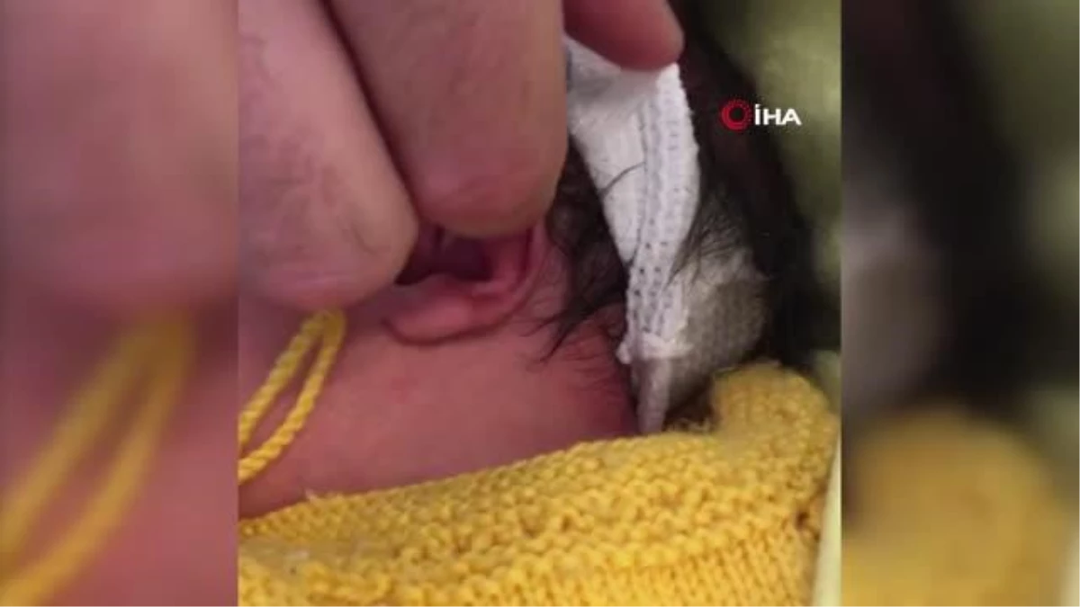 Bebeklerde kulak kıvrıklığına karşı "ev yapımı" tedavi