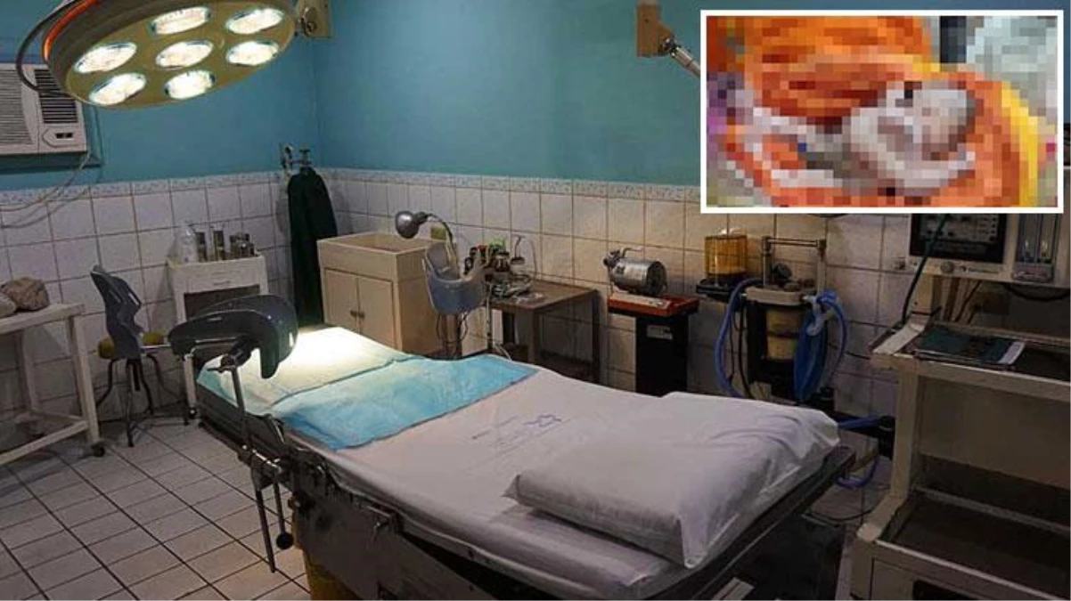 Doktor, doğumhanenin kapılarını kapatıp polisi aradı! Dört kollu ve dört bacaklı bebek infial yarattı