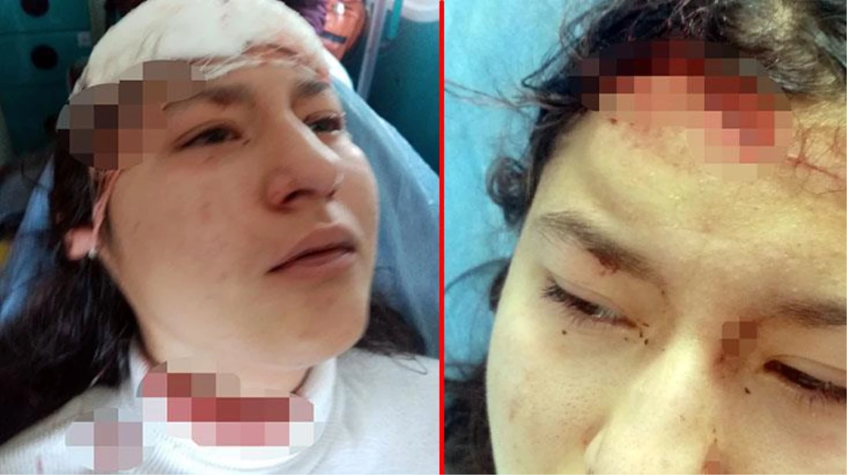 Fotoğraf çekilirken sokak köpeklerinin saldırısına uğrayan çocuğun yüzü parçalandı