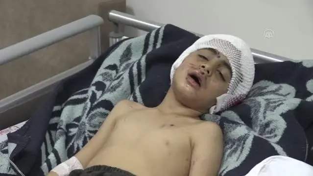 Sokak köpeğinin saldırısına uğrayan çocuğun sağlık durumu iyiye gidiyor