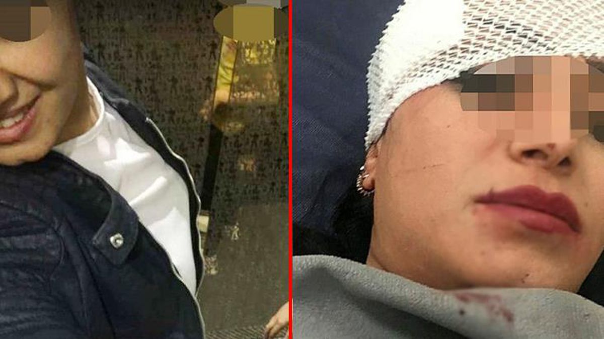 Kocasıyla ilişki yaşayan arkadaşının yüzünü ve omzunu jiletle kesti! Savunması pes dedirtti