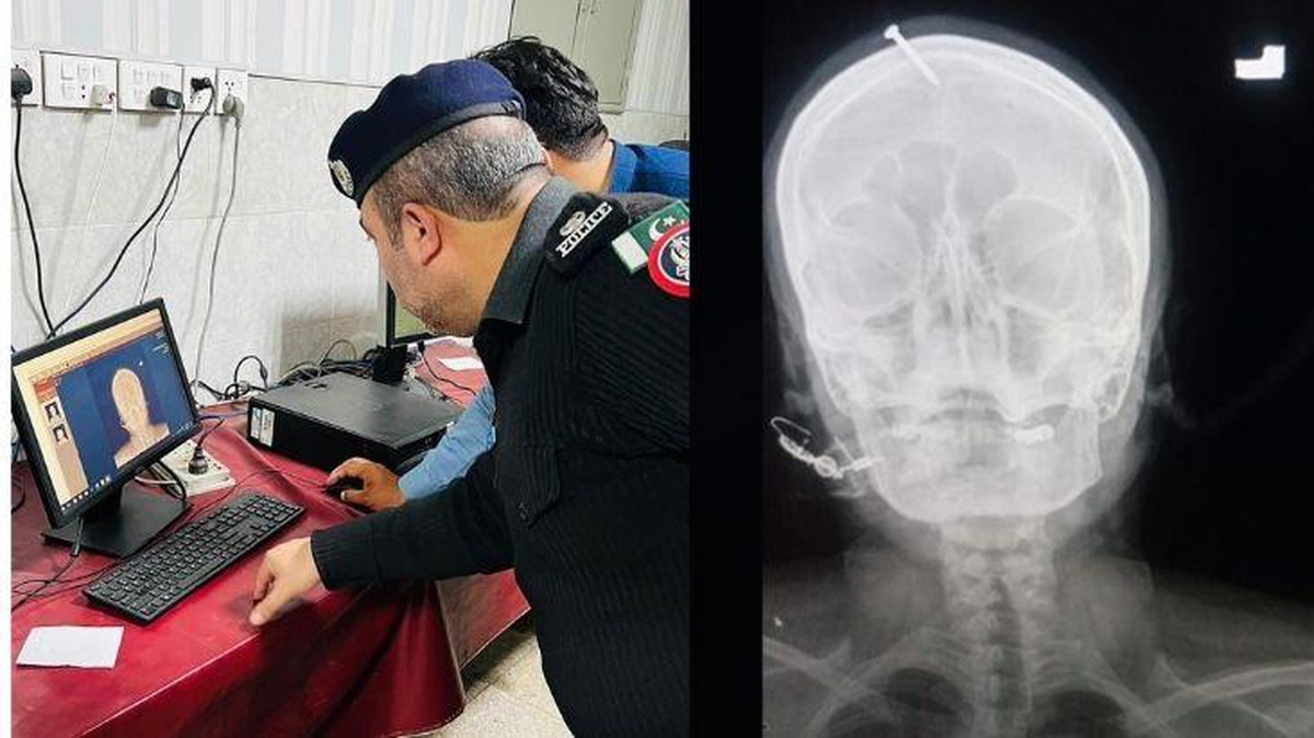 Erkek çocuğu olsun diye kafasına çivi çaktırdı! Polis her yerde sahte "şifacı"yı arıyor