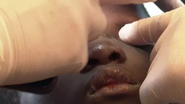 Afrikalı küçük Ebi'nin gözleri İstanbul'da açılacak Afrikalı küçük Ebi'nin gözleri İstanbul'da açılacak