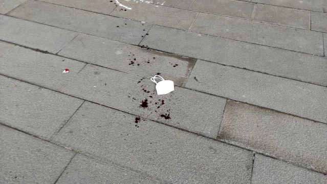 Bursa'da belediye başkan yardımcısına çirkin saldırı