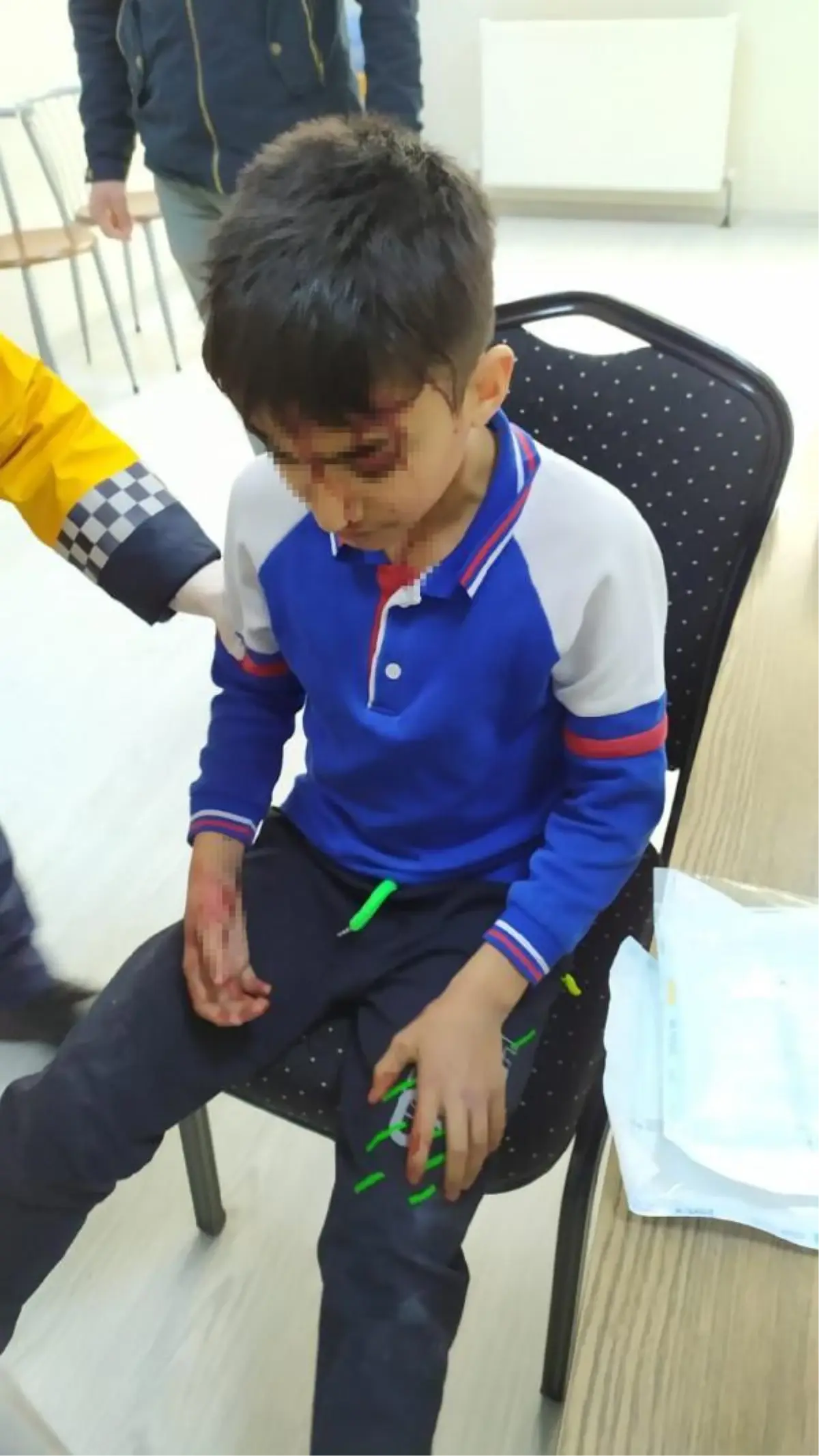 Efe, okul dönüşü köpek saldırısında başından yaralandı