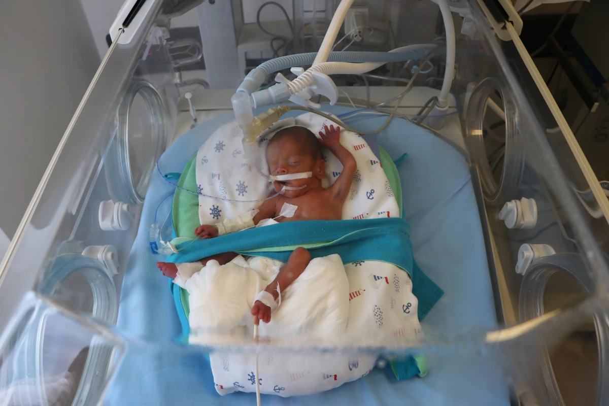 495 gramlık prematüre bebeğe kök hücre nakli: Dünyada ve Türkiye\'de sayılı nakil!