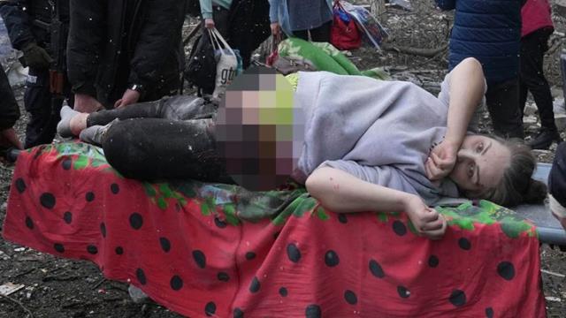 Rusya'nın hastaneye yaptığı saldırının simgesi olan hamile kadın, bebeğiyle birlikte hayatını kaybetti