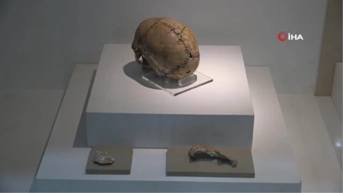 Dünyanın ilk beyin ameliyatı 10 bin 500 yıl önce Aksaray\'da yapıldı