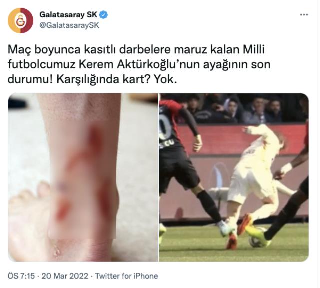 Galatasaray sosyal medyadan paylaştı! Kerem Aktürkoğlu'nun ayağının son hali içler acısı