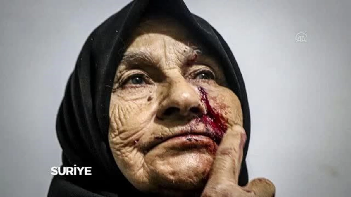 Ukrayna\'daki savaşın acıları Suriye\'deki dramla benzer karelere yansıdı