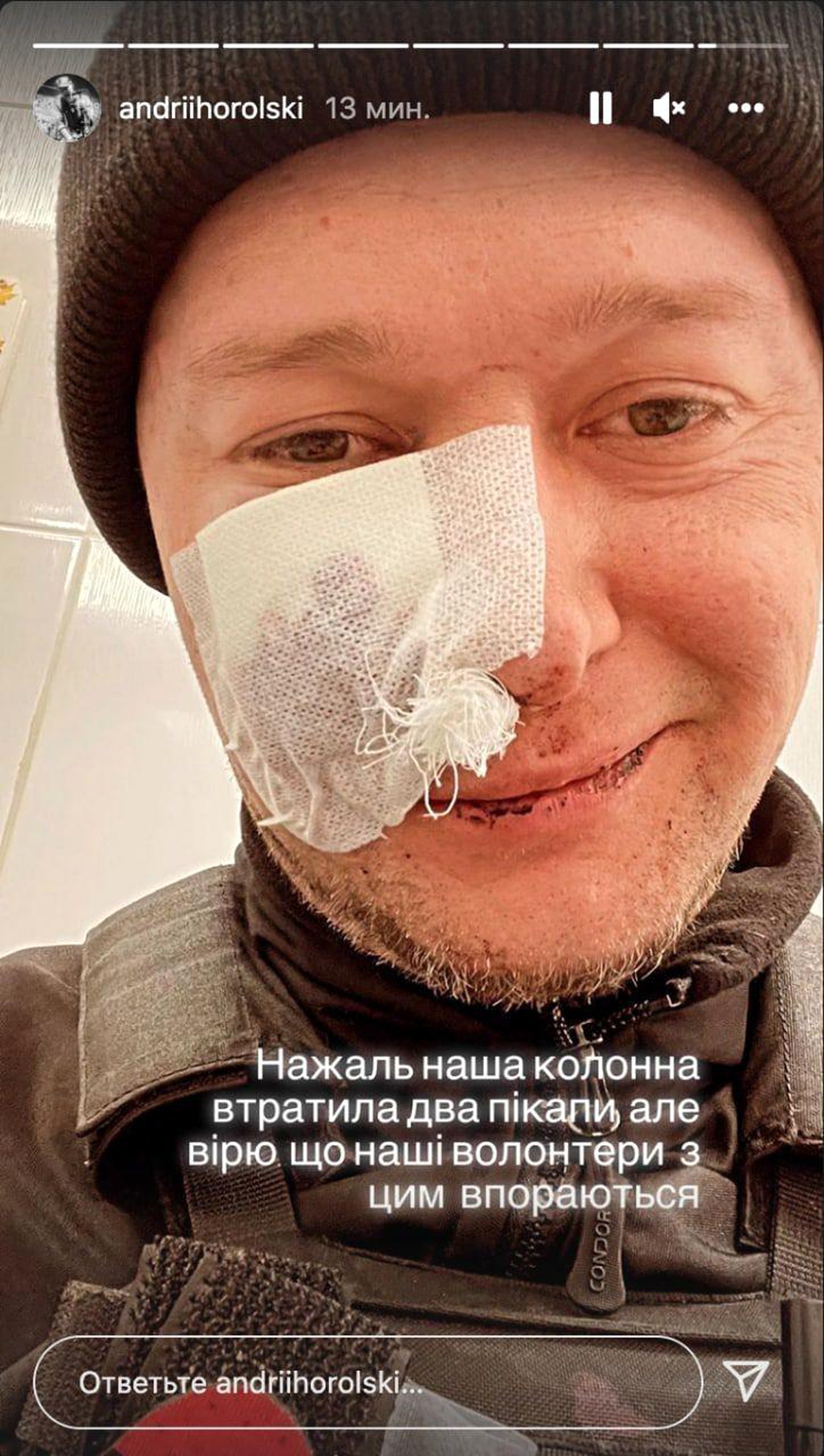 Orduya katılan Ukraynalı müzisyen, Rus saldırılarında yaralandı
