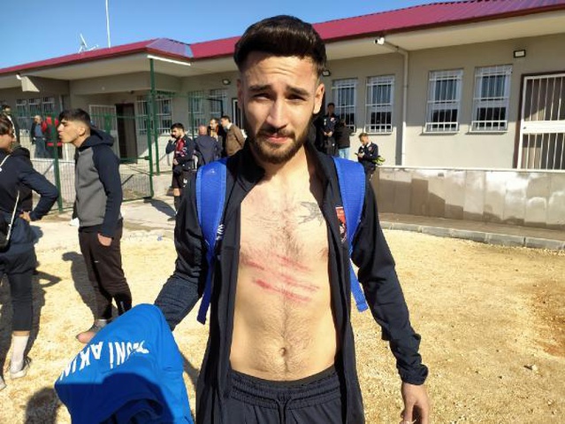 Adıyaman'da amatör maçta tekme tokat kavga