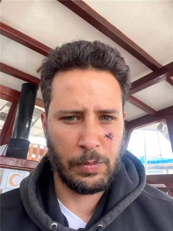 Tuan Tunalı'nın Yüzünü Köpek Isırdı