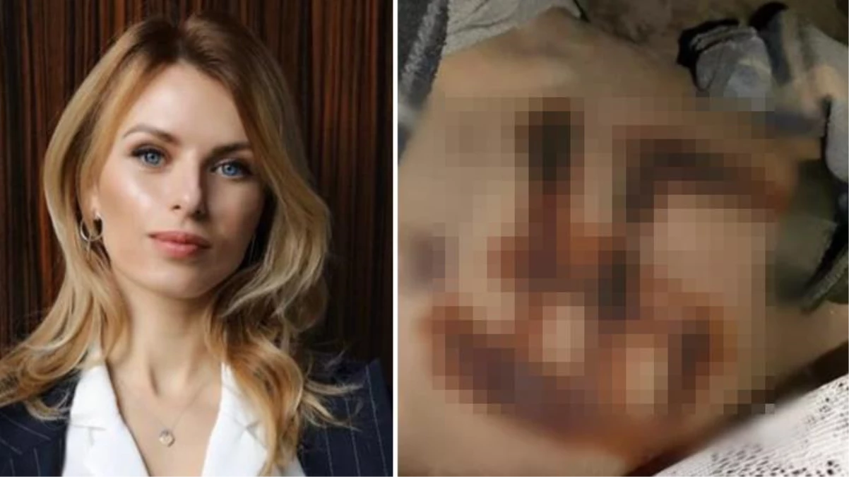 Vahşetin fotoğrafını Ukraynalı vekil paylaştı! Cinsel istismara uğradı, öldürüldü, cansız bedenine ateşle \'Gamalı haç\' kazındı