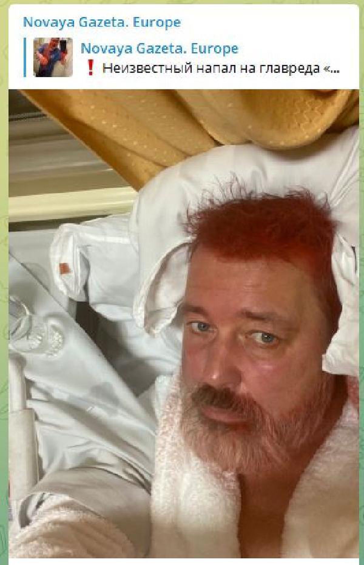 Rusya'da Nobel Barış Ödüllü muhalif gazete yöneticisine kırmızı boyalı saldırı