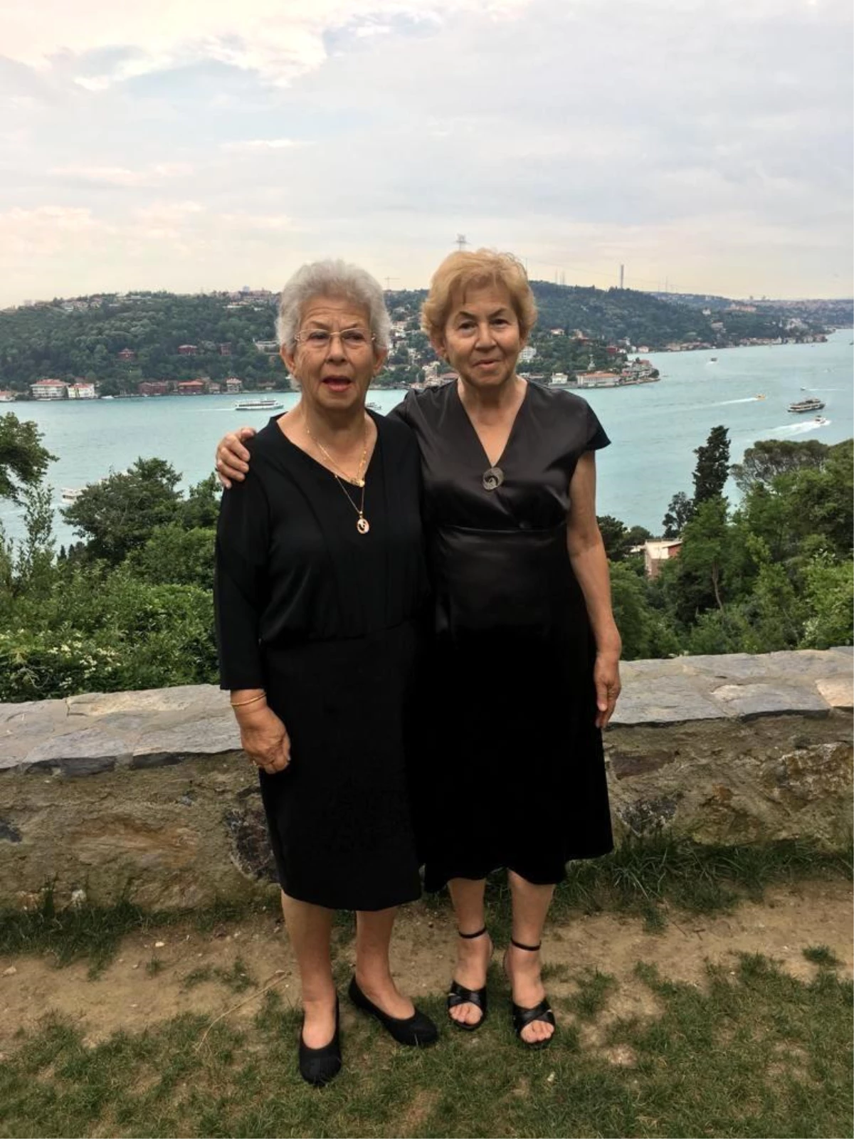 81 yaşındaki ikizlerin kaderi kalp kapağında da birleşti