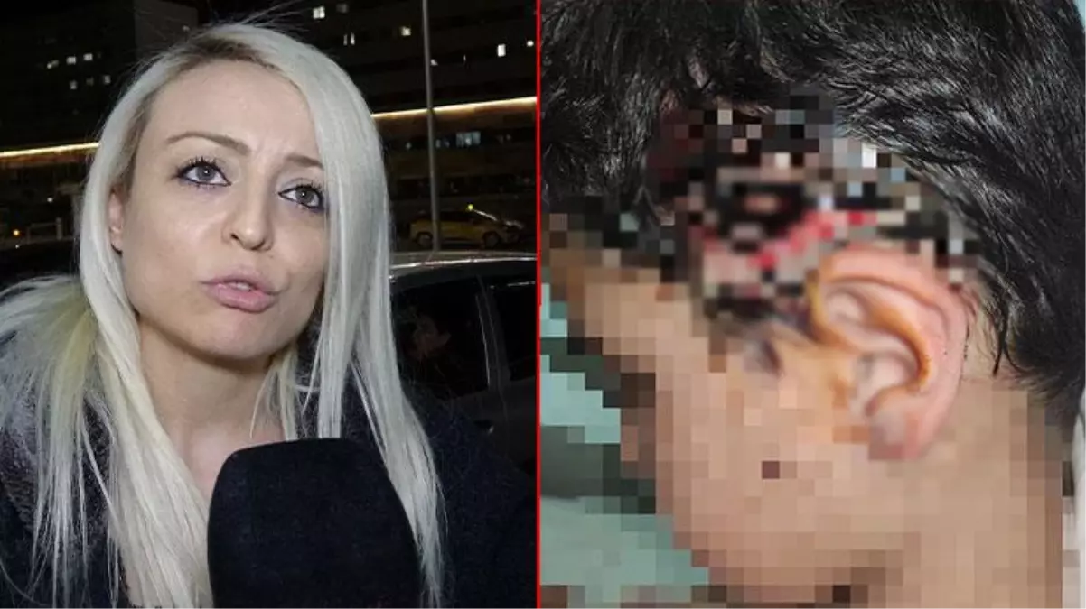 Okula giden 10 yaşındaki çocuğa 8 köpek saldırdı! Vücudunda 30 ısırık, 80 dikiş var