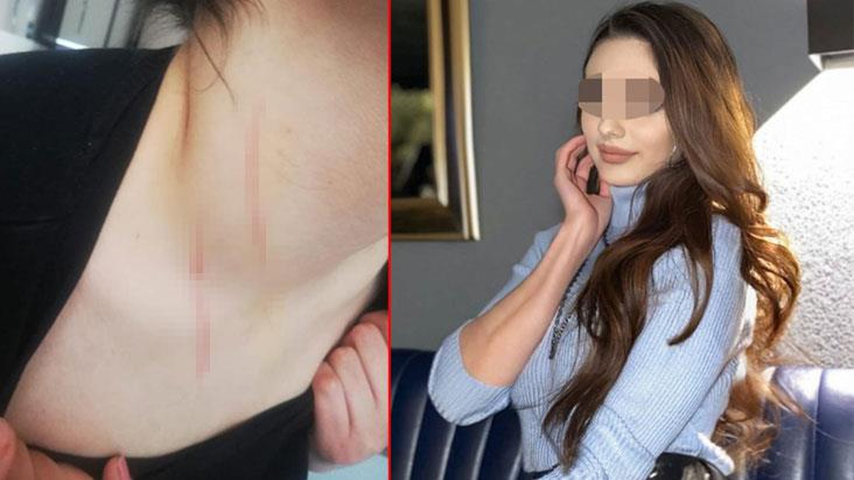 Kaçırılıp tehditle cinsel şiddete maruz kalan genç kadın yaşadıklarını anlattı: Göğsüme bıçakla imza attılar