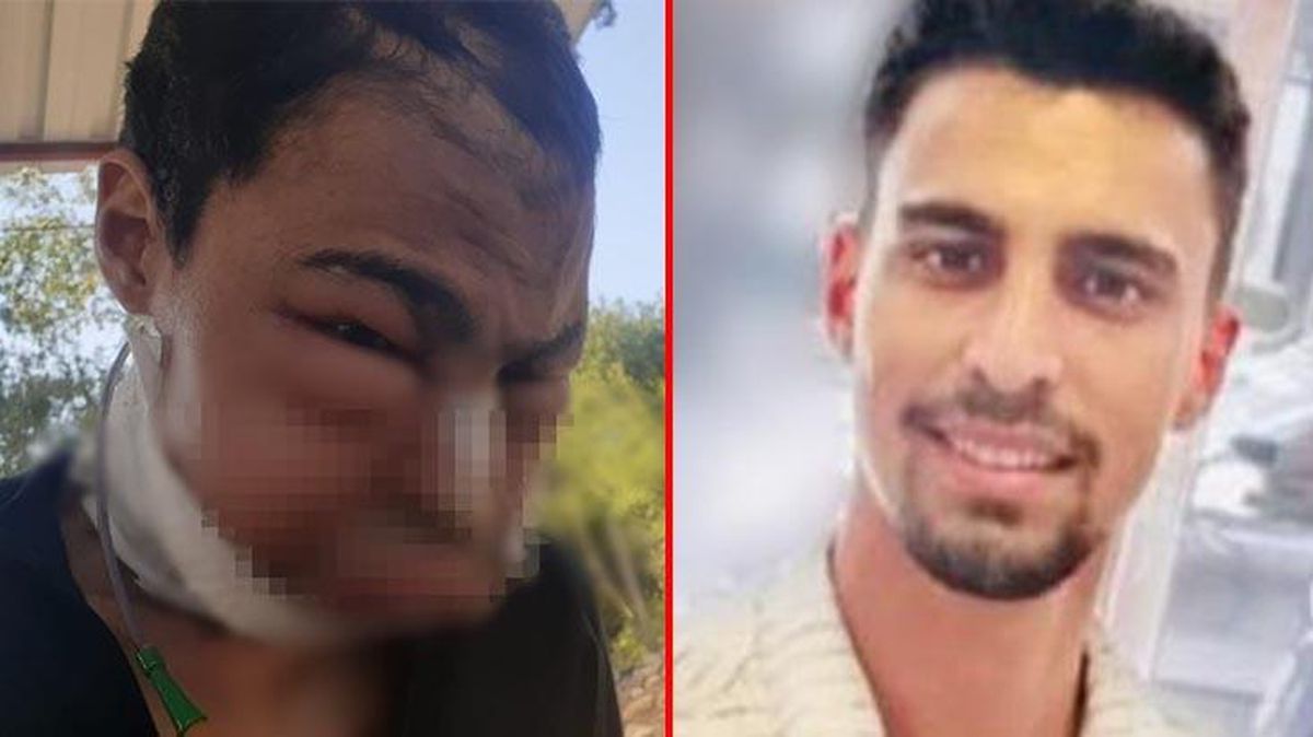 Osmaniyeli genç yakalandığı dil altı kanseri nedeniyle yaşamını yitirdi