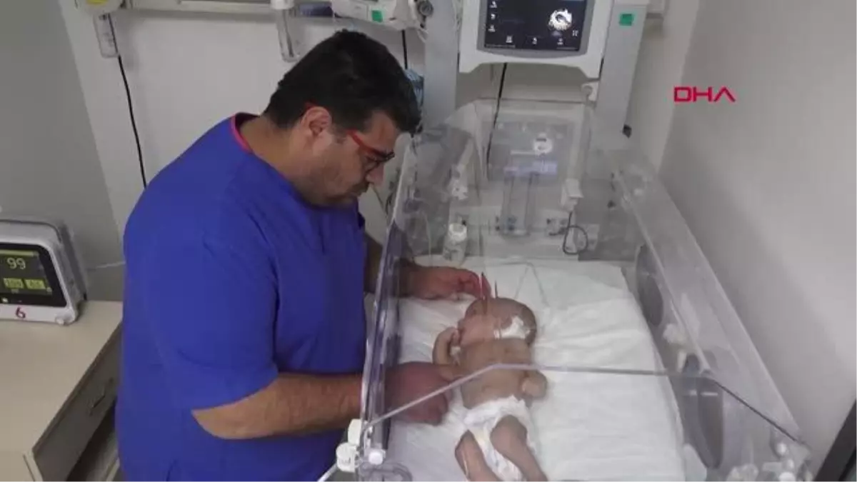 KAFASI BÜYÜYEN 2 HAFTALIK BEBEĞE ENDOSKOPİK AMELİYAT