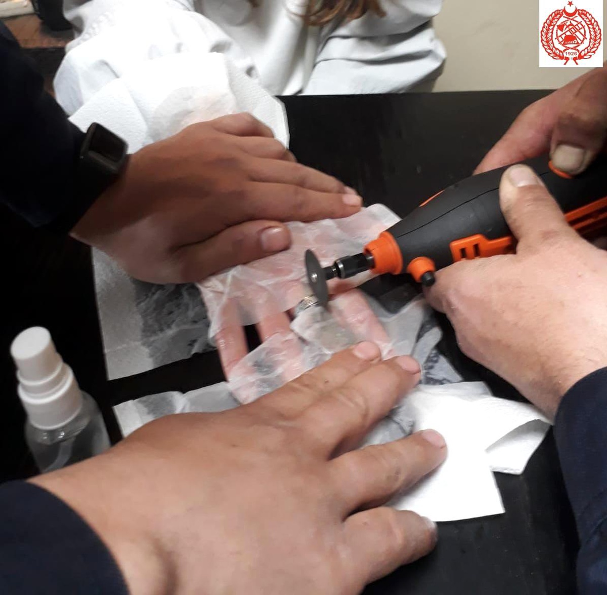 Parmağına sıkışan yüzüğü itfaiye çıkardı.