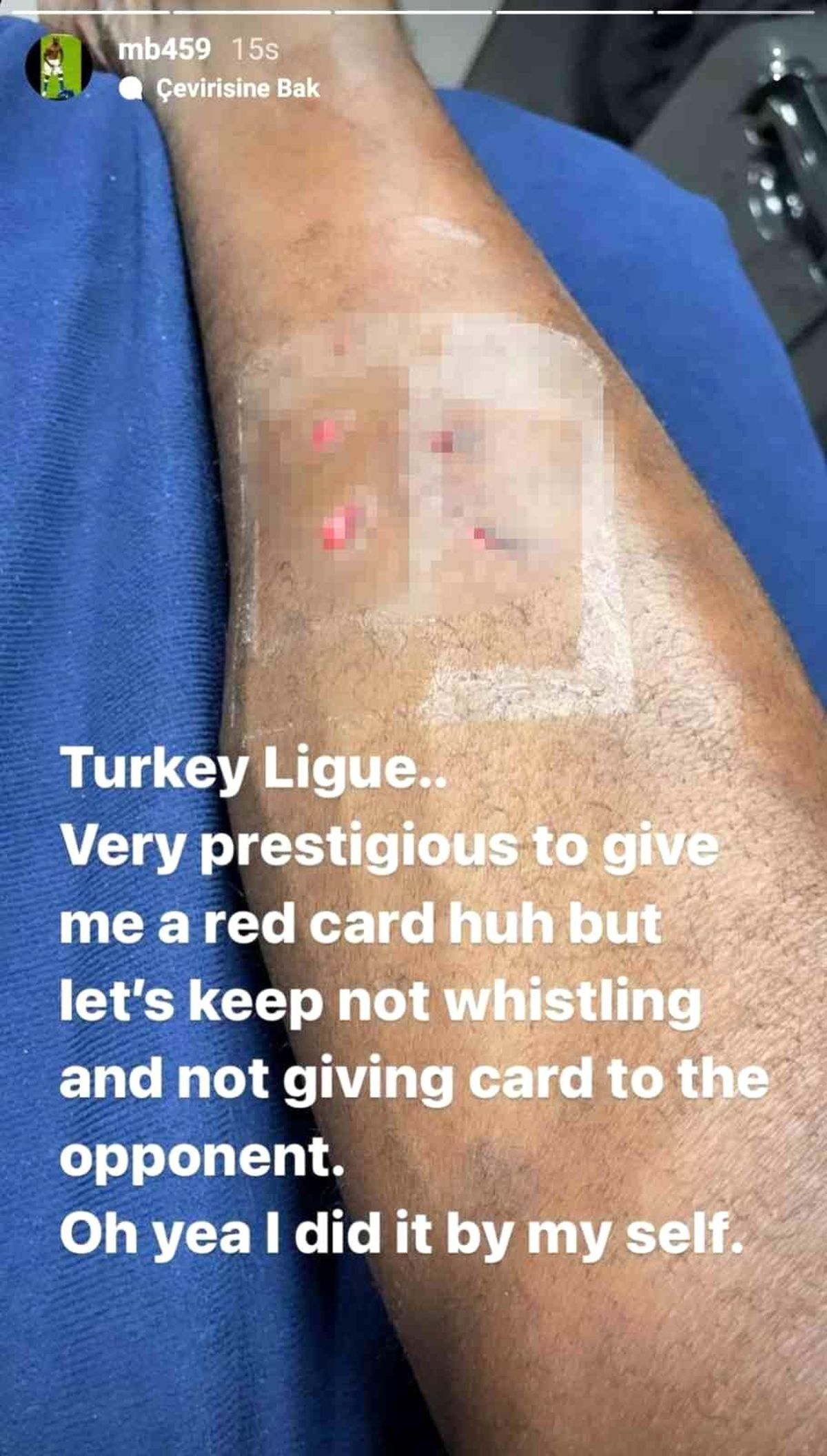 Balotelli\'den kırmızı kart tepkisi