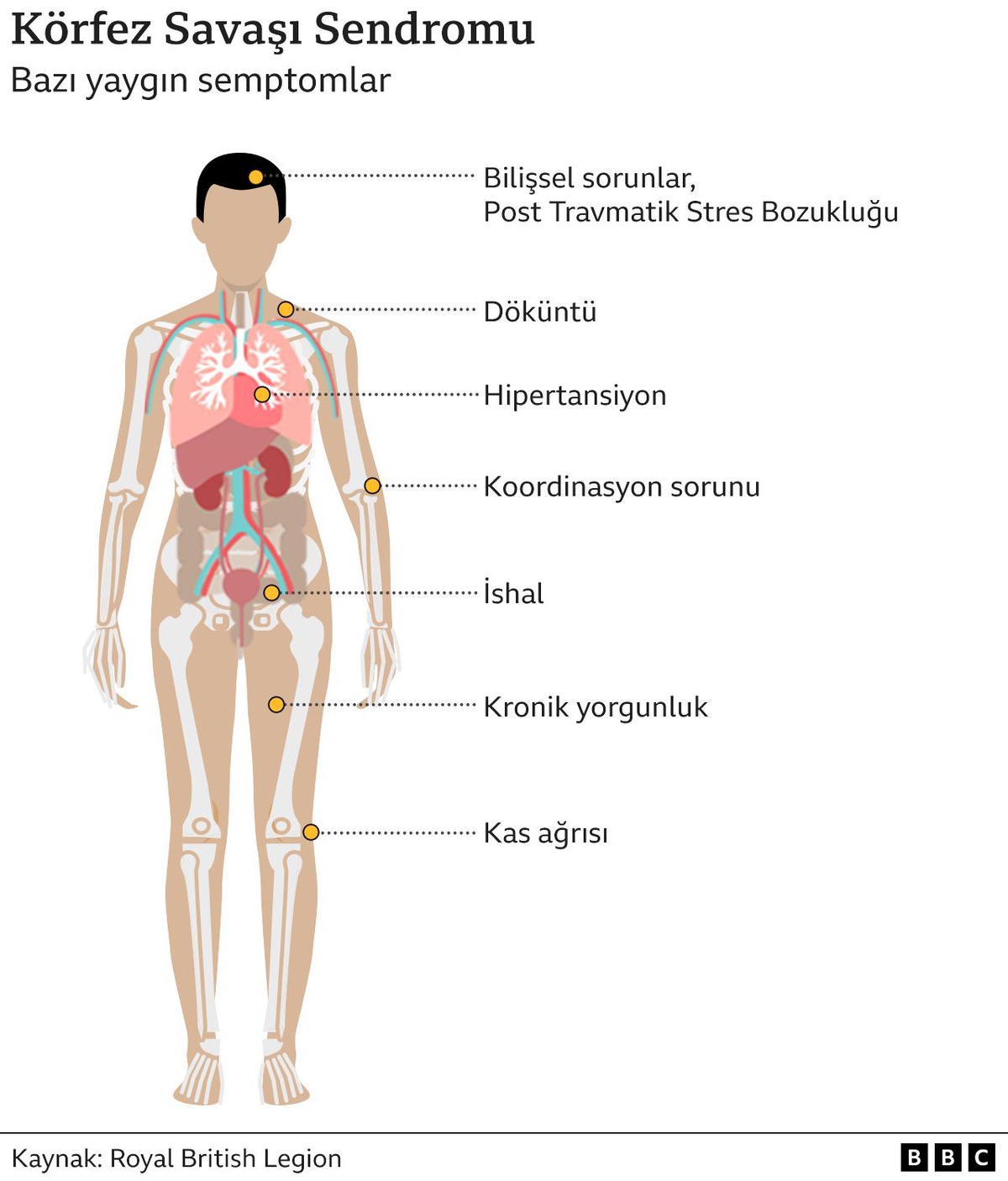 Körfez Savaşı\'na giden askerlerin gizemli hastalığının nedeni sarin gazı çıktı