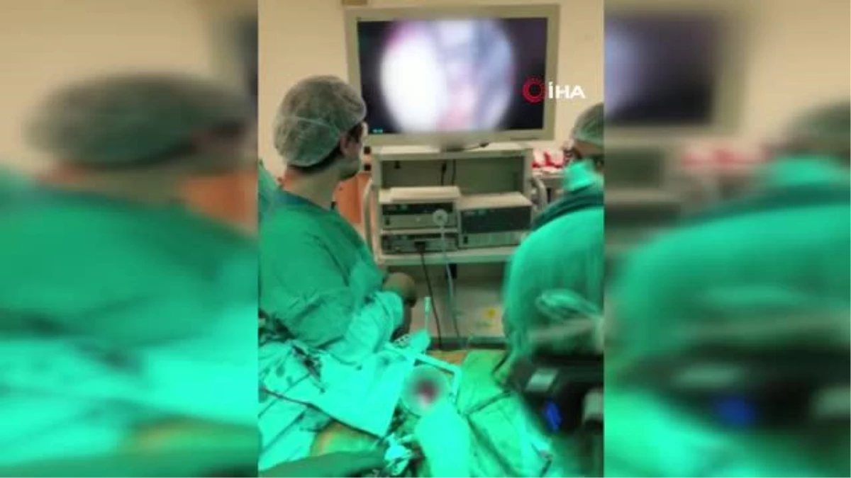 Bir hastaya aynı anda 4 kalp ameliyatı yapıldı