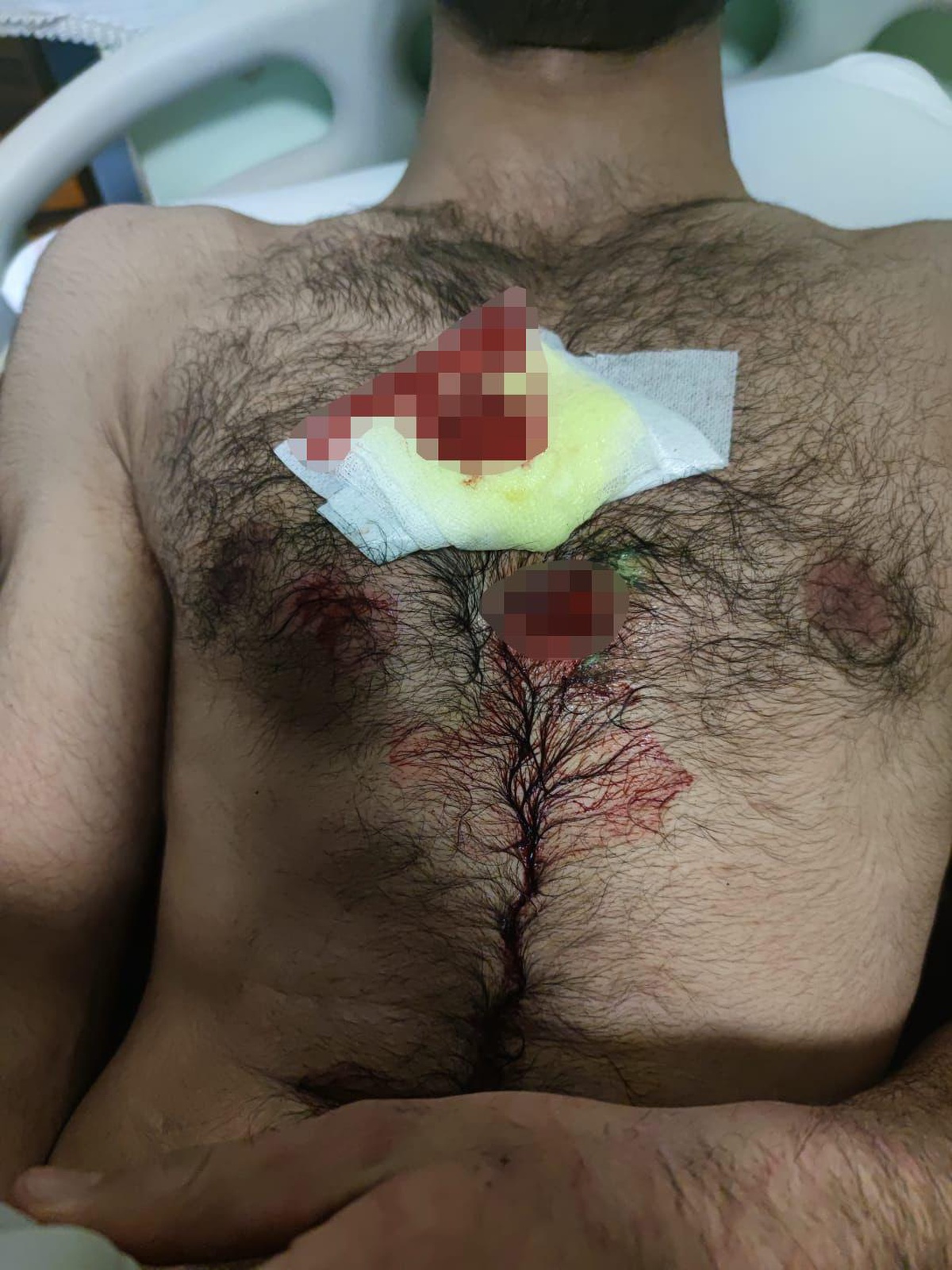 Yunanistan, sınırı geçmeye çalışan düzensiz göçmenlere karşı plastik mermi kullandı