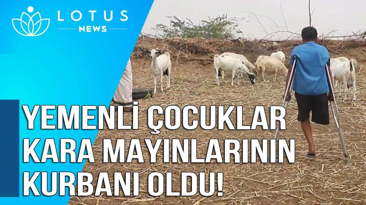 Video: Yemenli Çocuklar Kara Mayınlarının Kurbanı Oldu