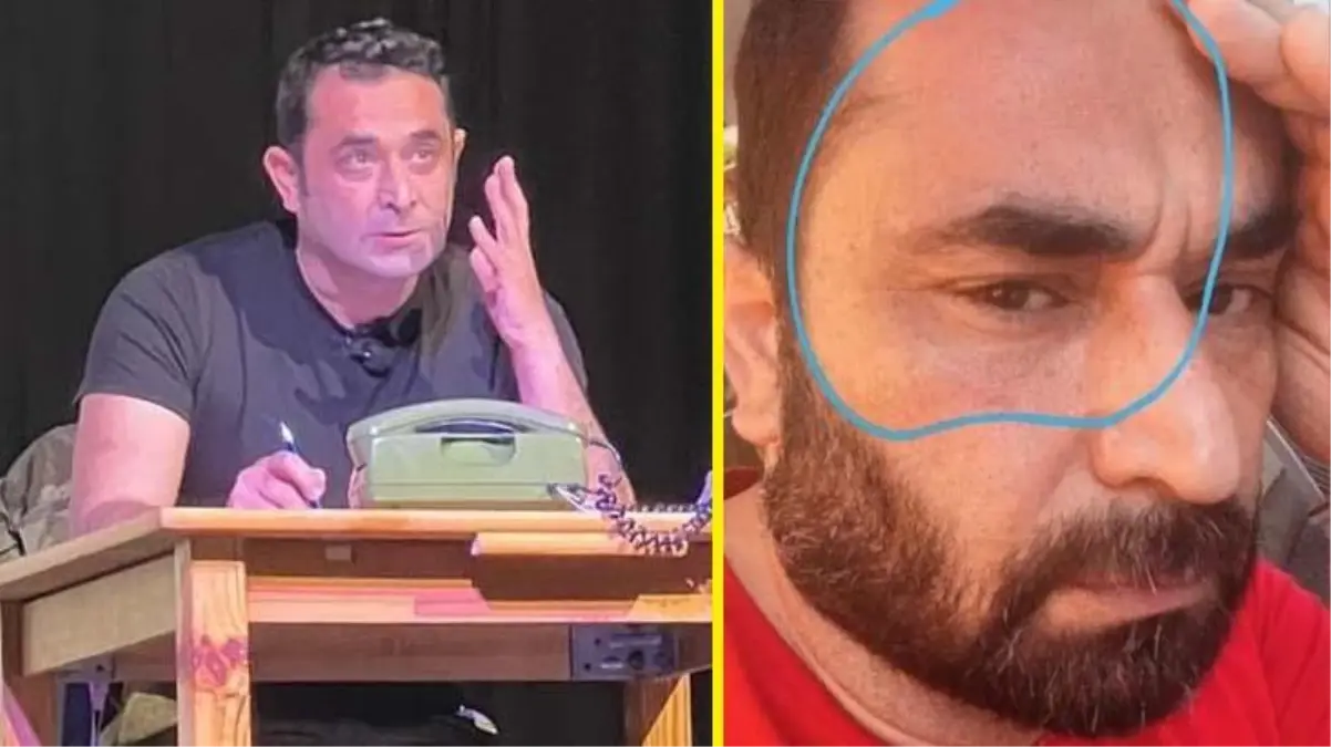 Tiyatro oyuncusu Serkan Aydın, Avusturya\'da sözlü ve fiziksel saldırıya uğradı!