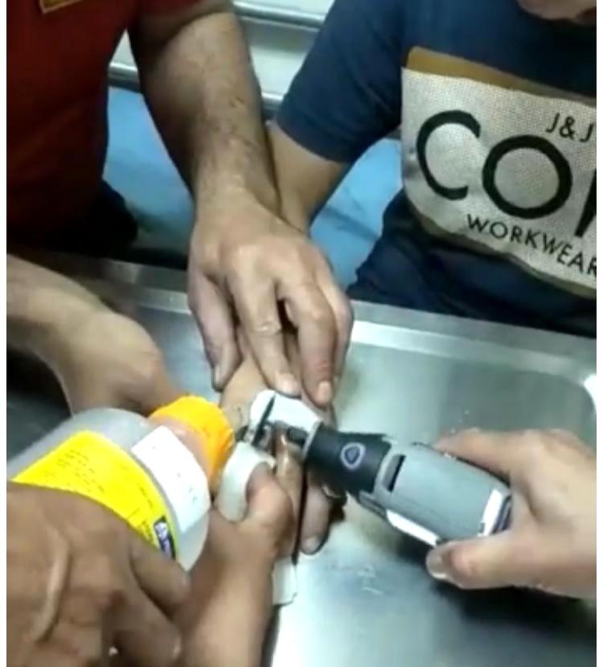 Çocuğun parmağına sıkışan metal somunu itfaiye çıkarttı