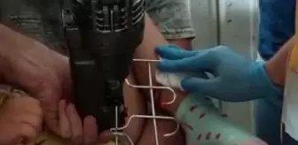 Esila'nın bacağına saplanan askıyı itfaiye kesti