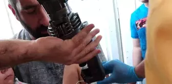 Oyun oynarken bacağına demir askılığın kancası saplandı