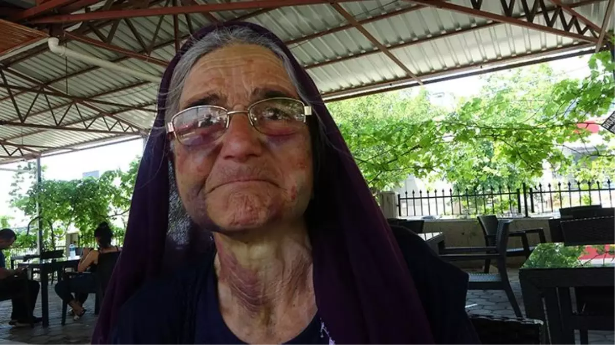 Kaçan kuzusunu almak isteyen yaşlı kadını darbedip polise "Eşekten düştü" dedi