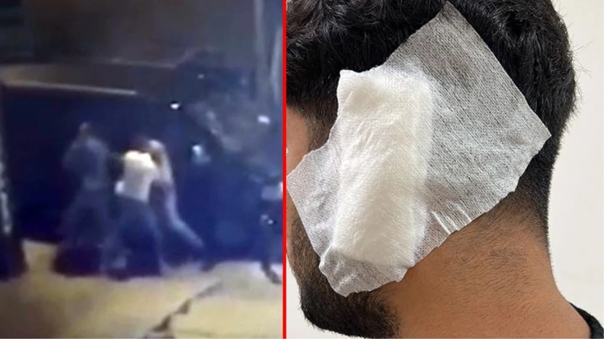 Akılalmaz kavga kamerada: Alçılı kolu ve falçatayla saldırdı, kulağını ısırdı
