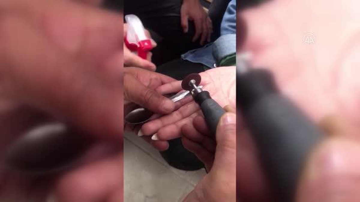 Bir kadının parmağına sıkışan yüzüğü itfaiye çıkardı