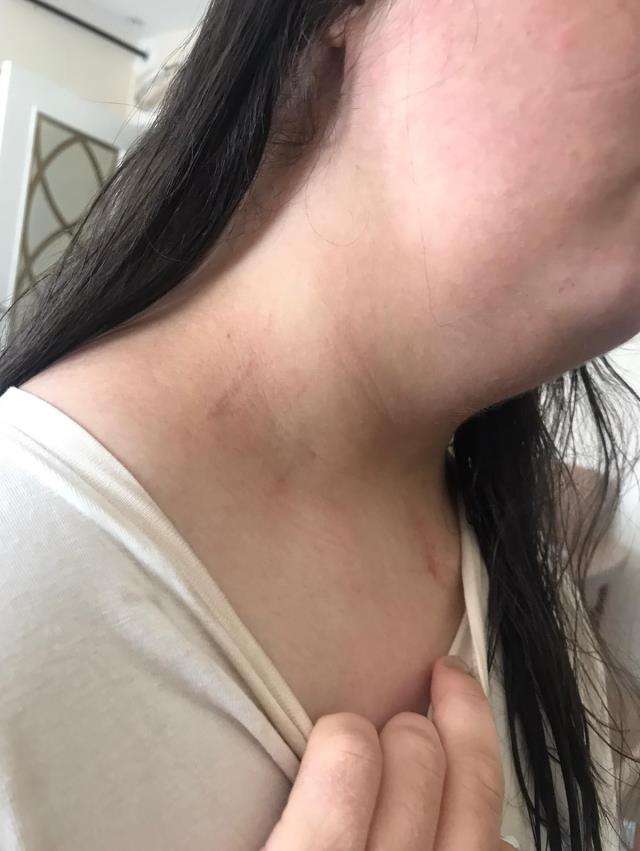 Düğünde 'saça dokunma' kavgası kötü bitti! Down sendromlu kız darp edildi, 1 kişi vuruldu Düğünde 'saça dokunma' kavgası kötü bitti! Down sendromlu kız darp edildi, 1 kişi vuruldu