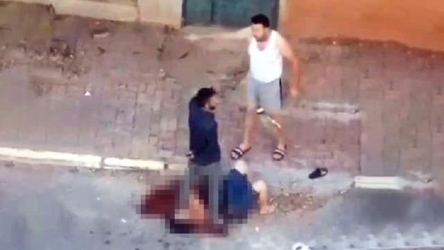 Sevgilisinin boğazını bıçakla kesti, yanına kimseyi yaklaştırmadı Sevgilisinin boğazını bıçakla kesti, yanına kimseyi yaklaştırmadı